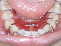 一般歯科 