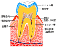 虫歯が全てではありません！