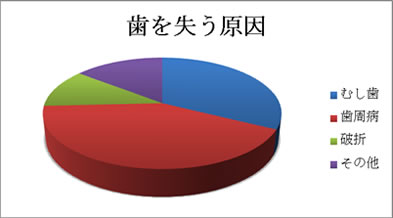 特徴３．歯を失う原因Ｎｏ．１ 